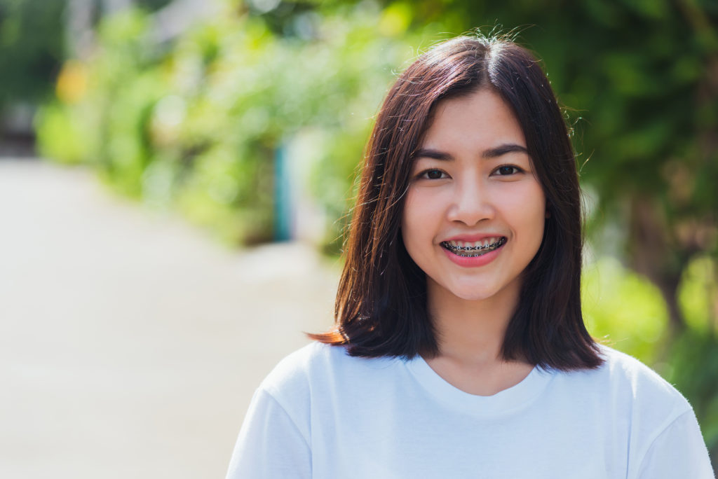 fort wayne orthodontics